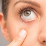 Göz Bozukluğu Neden Olur? Göz Tedavisi Nasıl Yapılır?
