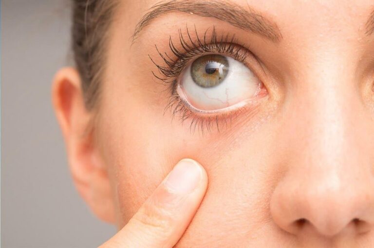 Göz Bozukluğu Neden Olur? Göz Tedavisi Nasıl Yapılır?
