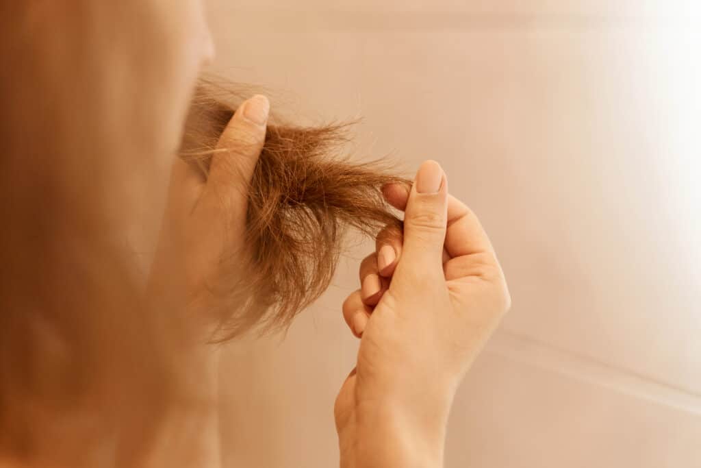 Saç Dökülmesine Ne İyi Gelir? Saç Dökülmesi Neden Olur?